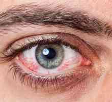 Alergija na oči: kako se postupa, efikasne metode i preporuke