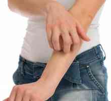 Alergija na rukama i nogama: uzroci, simptomi i karakteristike tretman