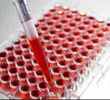 Test krvi za TB: funkcija, vrste i dešifriranje