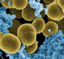 Analiza Staphylococcus aureus: kako i gdje da se dodavanje