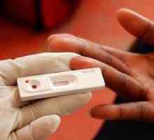 Test na HIV: smislu spremnosti, gdje i kada da se
