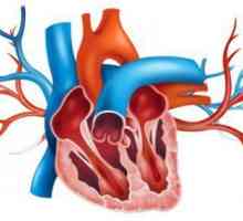 Aorta je zapečaćena - šta to znači? Tretman aorte pečata