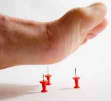 Bol u stopalu kada stepping: uzroci i tretmani
