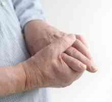 Bol u zglobovima prstiju: Uzroci, Liječenje