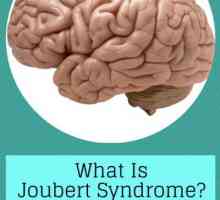 Bolest na nivou genetike - Joubert sindrom