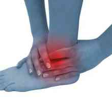 Bolesti koje pogađaju zglobove gležnja: artritis
