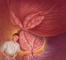Prostate bolesti: Liječenje Drug