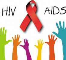 Koja je razlika između HIV-a i AIDS-a. Kako prepoznati simptome HIV-a, AIDS-a