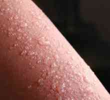 Šta izaziva osip na koži u obliku mjehurića?