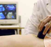 Šta i kako to učiniti ultrazvuk abdomena?