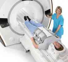 Šta MRI glave? Magnetna rezonanca