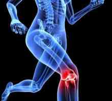 Ono što je deformisan osteoartritis koljena?