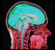 Koja je dijagnoza MRI? Mogućnost MRI dijagnostike. Dijagnoza MR mozga. Komentari o MRI dijagnostike