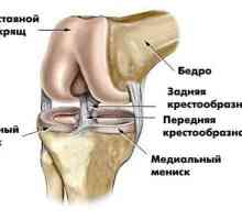 Ono što je MRI zgloba koljena kao rade da će MR koljena?