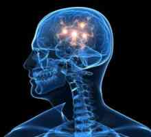 Ono što je promjena u fokalna mozgu supstance distrofije? Uzroci i simptomi fokalne promene u mozgu…