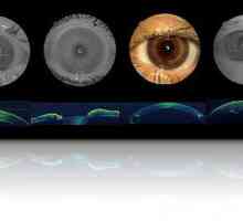 Šta je optička koherentna tomografija oči?