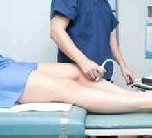 Što je ultrazvuk donjih ekstremiteta?