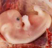 Ono što je vanmaterične trudnoće i koliko je opasno?
