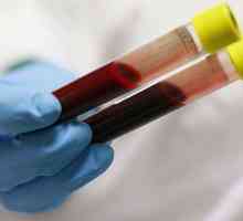 Dijagnosticiranje bolesti. Biohemijske analize krvi: tu emisiju?
