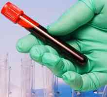 Zašto nam je potreban test krvi u onkologiji?