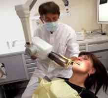 Zašto vam je potreban rendgen zuba