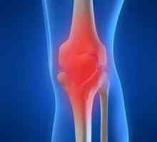 Dawa koljena: uzroci, simptomi u različitim fazama liječenja