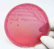 Escherichia coli u razmazu: Koliko je ozbiljno?