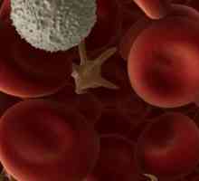 Ako povišene limfocita u krvi - šta to znači?
