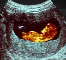Fetometry fetus od nedjelje. fetalni veličine u nedelju