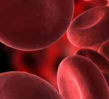 Folna kiselina anemije: uzroci, simptomi, tretman
