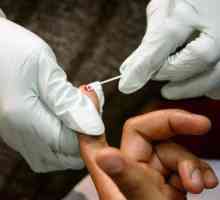 Gdje i kako da se testiraju na HIV anonimno
