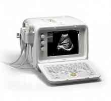 Gde ultrazvuk? izbor bolnice