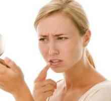 Herpes na usnama: tretman kod kuće. Koliko brzo izliječiti hladno rane na usnama kod kuće?