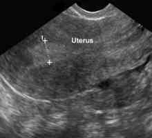 Ginekološki ultrazvuk: bilo koji dan ciklusa, u kojoj rade, dešifrovanja