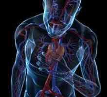 Hipoksija infarkt: Simptomi i tretman