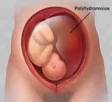 Fetalne hipoksije - Simptomi i tretman