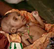 Neuhranjenosti kod djece i simptome