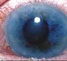 Glaukom tretman na prvi znak bolesti
