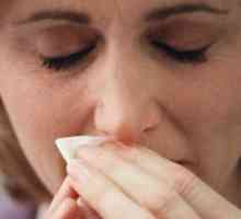 Gnoj iz nosa, ili ono što je sinusitis