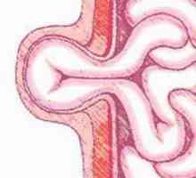 Abdominalna hernija: njihova simptomi i liječenje