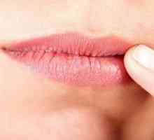 Inflamacija usana na usnama: vrste, uzroci i liječenje