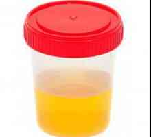 Kemijske i toksikološka ispitivanja urina