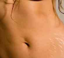 Informacije za žene: kako ukloniti strije na stomaku