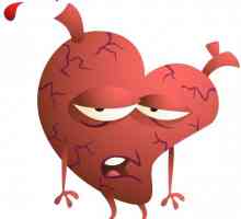 Koronarne bolesti srca. Šta je to i koje su njegove simptome?