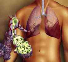 Efikasan tretman upale pluća kod kuće