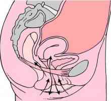 Efektivna Kegelove vježbe za uterusa prolaps