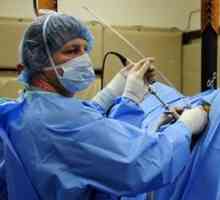 Endoskopske operacije: mogućnosti, prednosti i mane