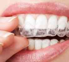 Kako se koristi za usta za zube. Izbjeljivanje genitalije. Stomatologija - kape
