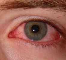 Kako da biste dobili osloboditi od sindroma suhog oka?