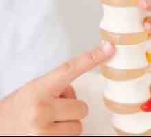 Kako tretirati osteohondroze vratne kralježnice. Osteohondroza vratne kralježnice: tretman kod kuće